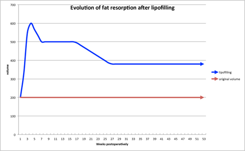 lipofilling in general 5